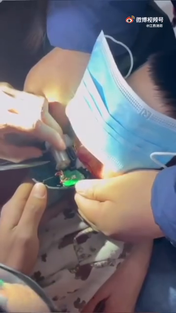 看着都痛！男孩玩电动指甲剪把舌头夹出血