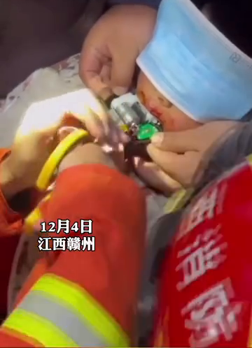 看着都痛！男孩玩电动指甲剪把舌头夹出血