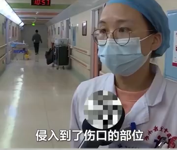 5岁男孩常挖鼻孔致反复高烧、面部红肿似奥特曼